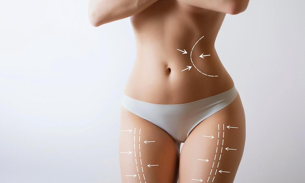The Most Common Myths About Liposuction Debunked
