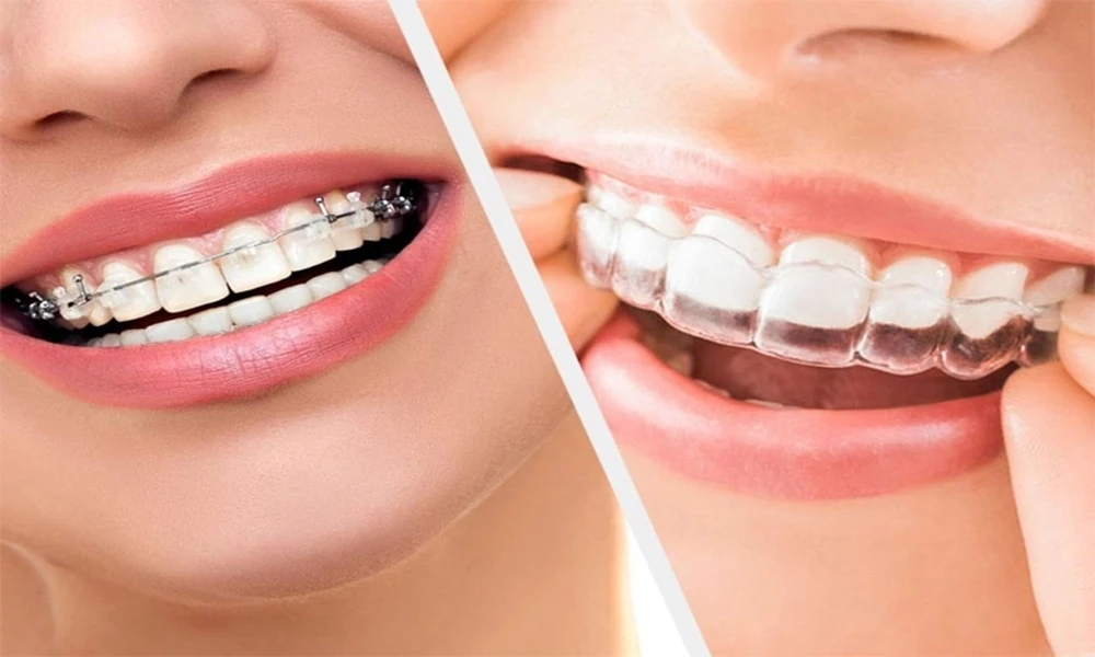 How Pediatric Dentists Discuss Tooth Development With Adoptive Families